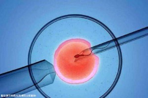 助孕借卵试管机构生殖中心